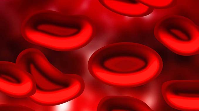 sangue